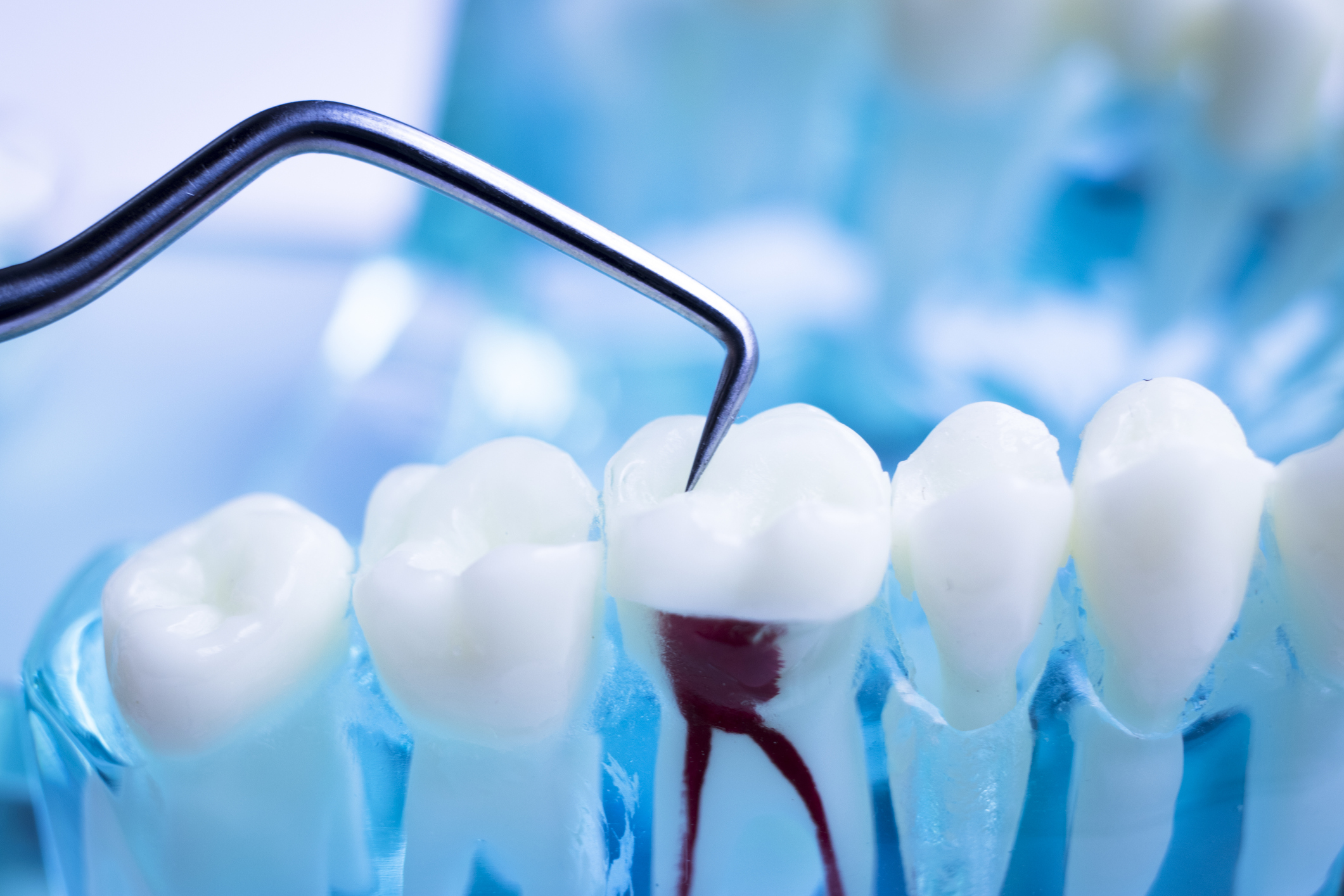 endodontiste verviers