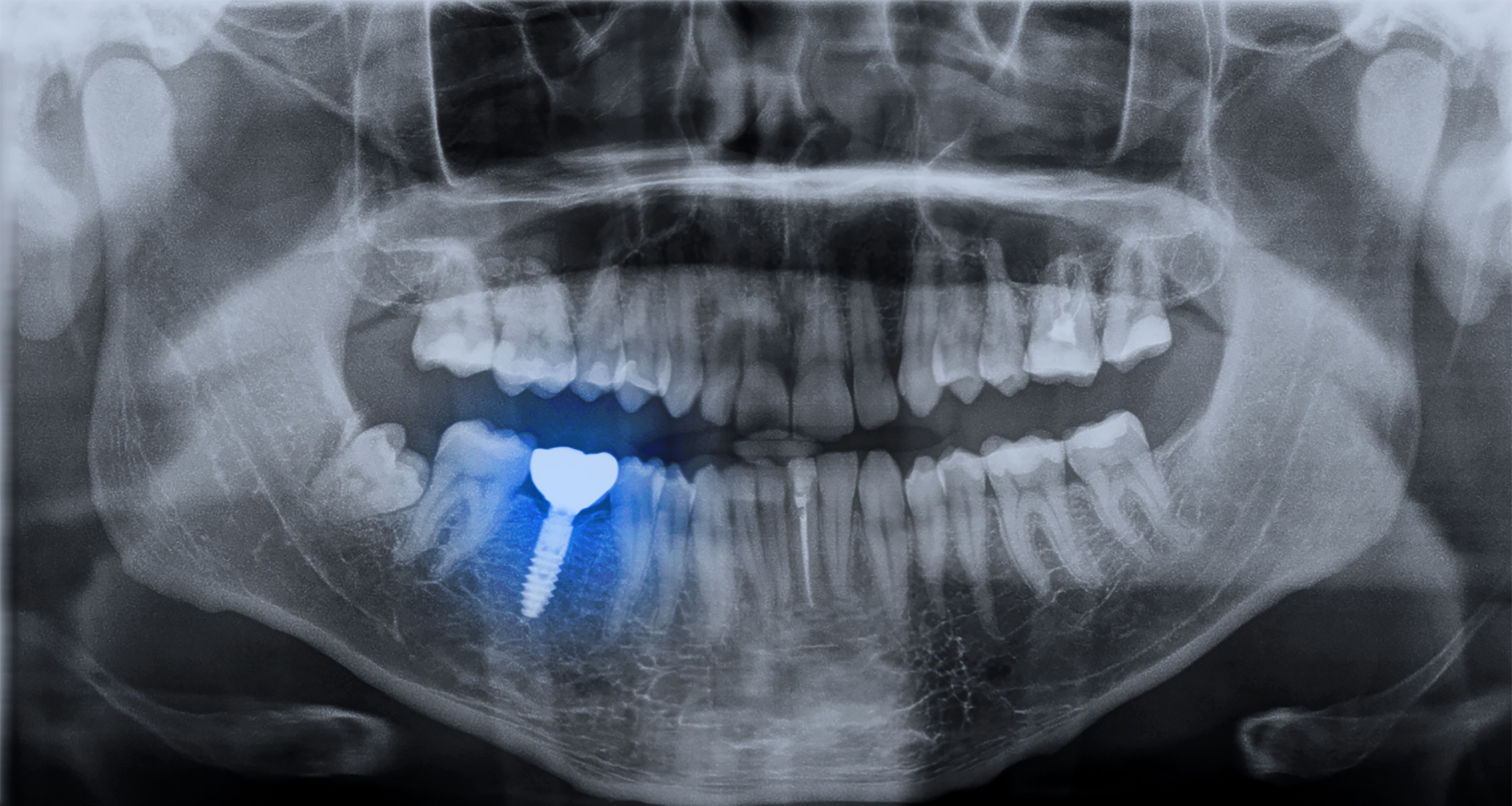radio des dents verviers